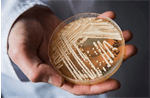Scientists warn of deadly drug-resistant fungus spreading worldwide